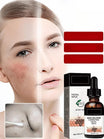 Melanin Repair Facial Essence - Brightening & Even Skin Tone Serum