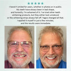 All-Inclusive Denture Care Kit - Custom Fit Denture Enhancement & Maintenance Set