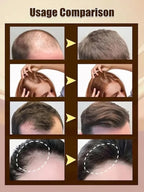 Batana Hair Growth Oil - Natural Hair Thickening & Follicle Care Formula