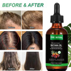 Batana Hair Growth Oil - Nourishing Hair Strengthening & Smooth Shine Formula