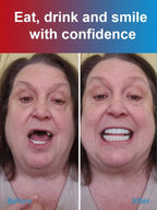 Cosmetic Denture Care Set - Fast Fit Comfortable Dental Prosthetic Solution