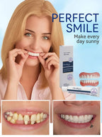 Cosmetic Denture Care Set - Fast Fit Comfortable Dental Prosthetic Solution