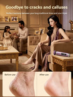 Electric Foot File - Instantly Removes Calluses & Dead Skin