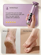 Electric Foot File - Instantly Removes Calluses & Dead Skin