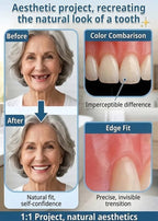 Full Coverage Dentures - Comfortable Cosmetic False Teeth with Free Portable Storage Box