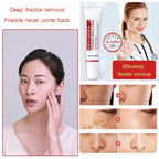 Fuyan Whitening & Anti-Freckle Cream - Chinese Herbal Dark Spot Brightening Skincare Treatment