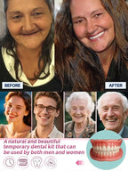 High-Quality Denture Set - Buy 1 Get 1 Free Comfortable Replacement Teeth Kit
