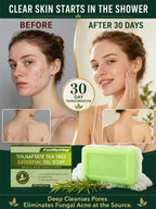 High-Strength Tea Tree Oil - Targets Fungal Biofilm & Drug Resistance