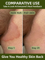 High-Strength Tea Tree Oil - Targets Fungal Biofilm & Drug Resistance