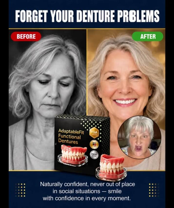 Instant Smile Veneers - At-Home Cosmetic Teeth Cover for a Brighter Smile Appearance