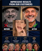 Instant Smile Veneers - At-Home Cosmetic Teeth Cover for a Brighter Smile Appearance