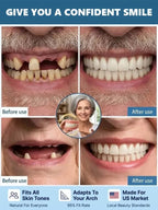 Instant Smile Veneers - Hollywood-Style Cosmetic Teeth Covers in Seconds
