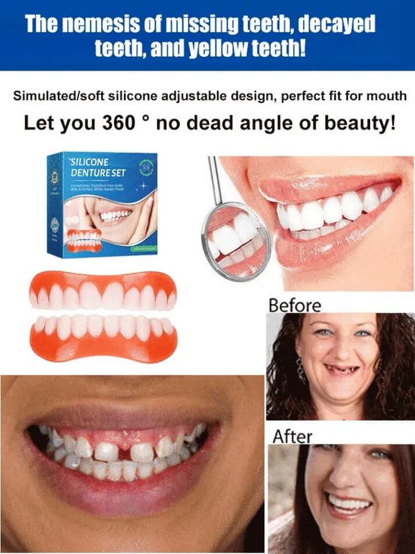 Medical-Grade Silicone Braces - Japanese-Style Orthodontic Comfort Aligners