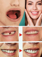 Medical-Grade Silicone Braces - Japanese-Style Orthodontic Comfort Aligners