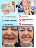 Medical-Grade Silicone Dental Veneers - Invisible Comfort-Fit Cosmetic Teeth Covers Crafted by Zurich Dental Experts