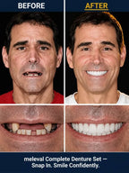 Medical-Grade Silicone Teeth Veneers - Thermoplastic Removable Cosmetic Dental Cover Set