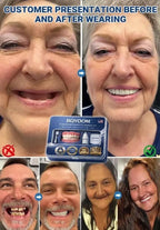 Medical-Grade Silicone Veneers - Comfortable Fit with Advanced Thermoplastic Technology