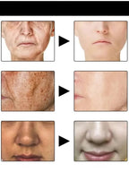 Melanin Repair Facial Essence - Brightening & Even Skin Tone Serum