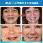 Perfect Smile Denture Set - Instant White, Natural-Looking Teeth