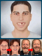 Perfect Smile Dentures - Comfortable Strong-Bite False Teeth for Daily Eating