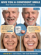 Professional Denture Kit - Restore a Natural Smile & Save on Clinic Costs