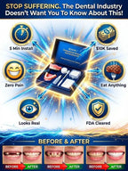 Professional Denture Set - Medical-Grade Full Tooth Replacement Solution
