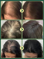 Rosemary Hair Growth Shampoo - Doctor-Recommended Scalp & Hair Care Formula