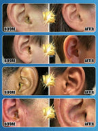 Safe Ear Wax Cleaner - Gentle Ear Cleaning Tool for Quick Wax Removal