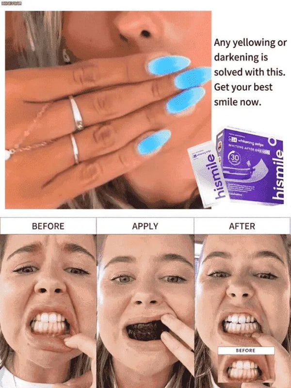Teeth Whitening Solution - Brighter Smile in 7 Days, Stain Removal in 30 Minutes