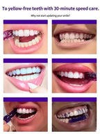 Teeth Whitening Solution - Brighter Smile in 7 Days, Stain Removal in 30 Minutes