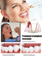 Tooth Regeneration Care Drops - Oral Repair & Enamel Support Formula